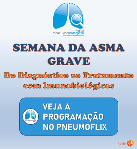 SEMANA DA ASMA GRAVE NO PNEUMOFLIX